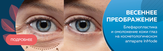 20250128_Столица_Блефаропластика_Весеннее_преображение_v01_слайдер.jpg
