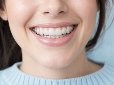 Как работает система 3D Smile