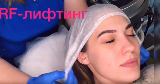 RF-лифтинг