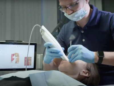 3D сканирование зубов в клинике «Столица»