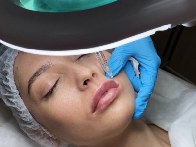 Контурная пластика губ кейс 1