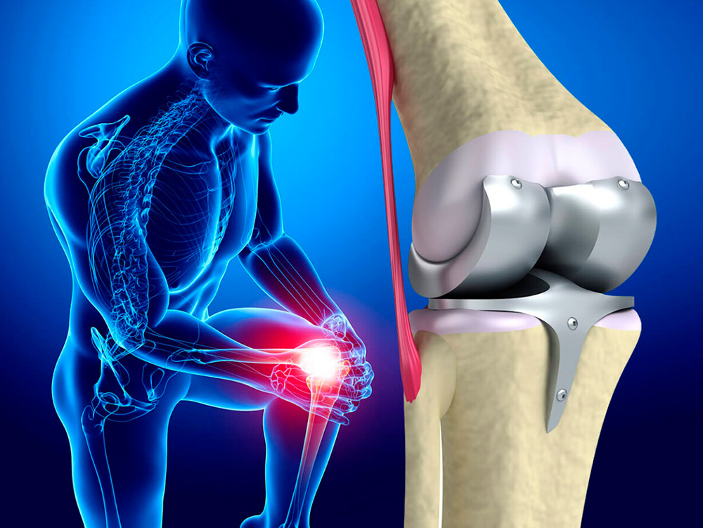 Эндопротезирование тазобедренного и коленного сустава