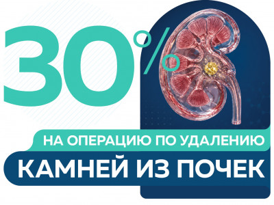Скидка 30% на операцию по удалению камней из почек