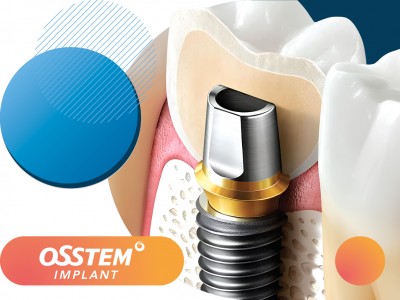 Имплантация под ключ: имплант OSSTEM + циркониевая коронка за 65 000 руб. для вашей безупречной улыбки!