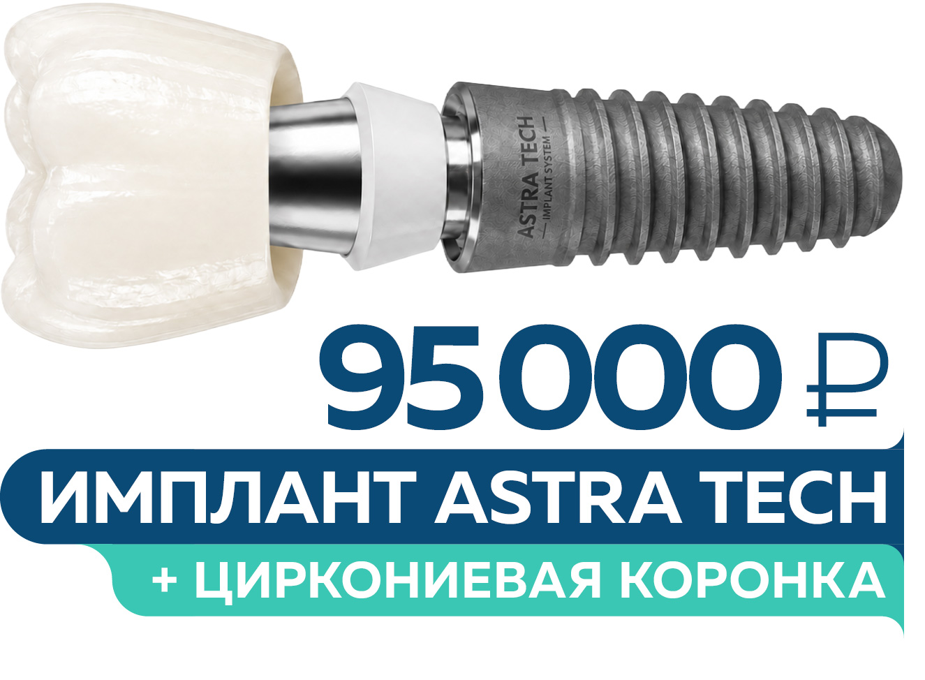 Всё включено: имплант Astra Tech + циркониевая коронка за 95 000 руб.!