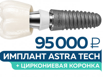 Всё включено: имплант Astra Tech + циркониевая коронка за 95 000 руб.!