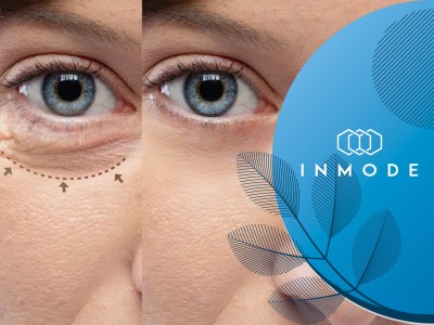 Блефаропластика и омоложение кожи глаз на косметологическом аппарате InMode