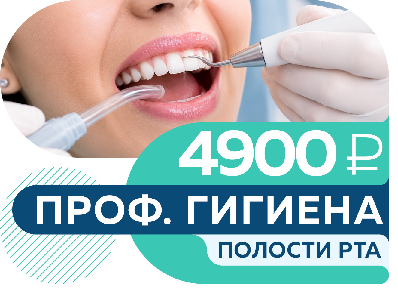 Все включено! Профессиональная гигиена полости рта за 4 900 руб.