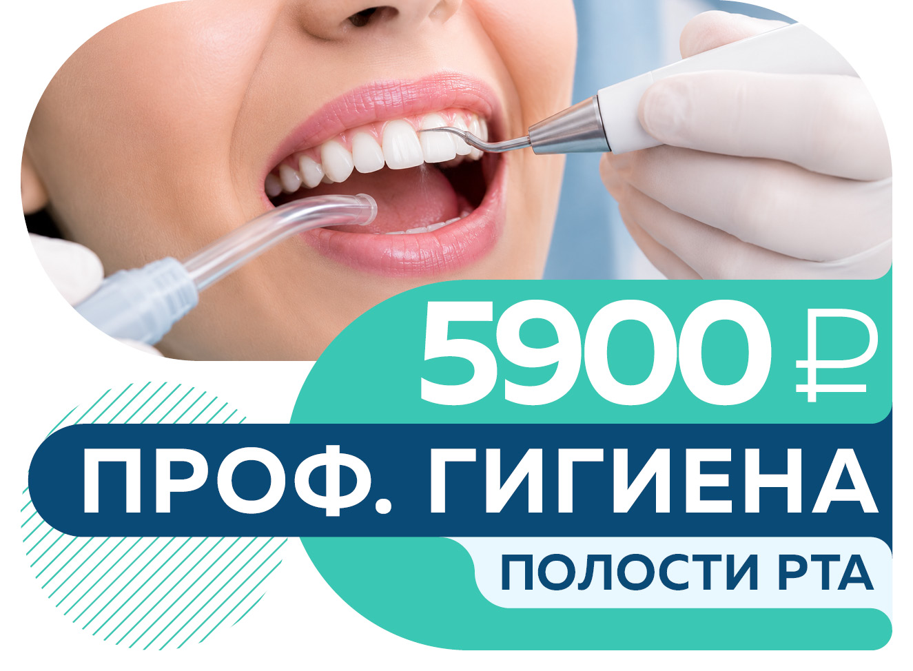 Все включено! Профессиональная гигиена полости рта за 5 900 руб.