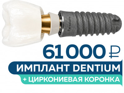 Имплантация Dentium под ключ – 61 000 руб.