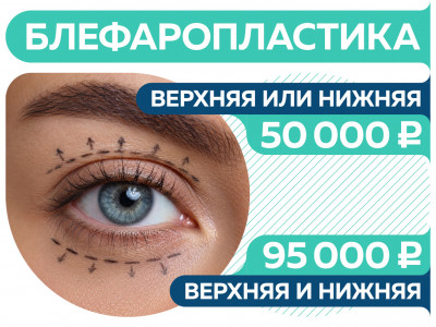 Блефаропластика по акционной цене
