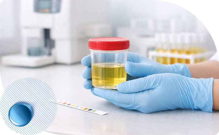 Общий анализ мочи в Москве в клинике Столица