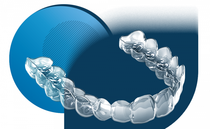 3d smile элайнеры: стоимость в Москве | Поставить капы 3д смайл под ключ