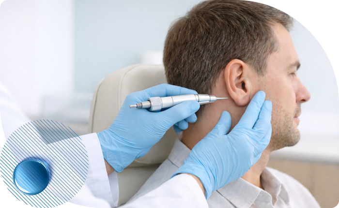 Биопсия уха: цена в Москве | Сделать ЛОР-биопсию