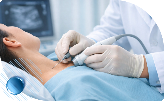 Биопсия лимфоузла на Профсоюзной в клинике Столица