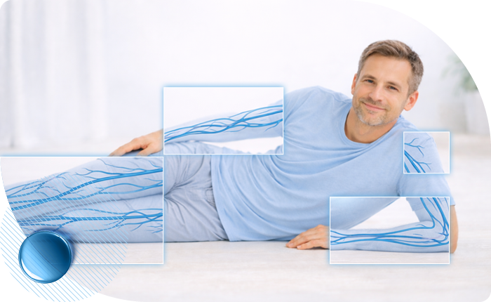 Лечение варикозного расширения вен (варикоза) в Москве в клинике Столица