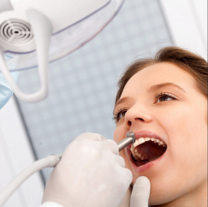 Лечение кариеса в Москве Лечение кариеса в Москве