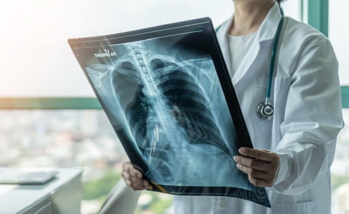 Рентген грудной клетки в Москве