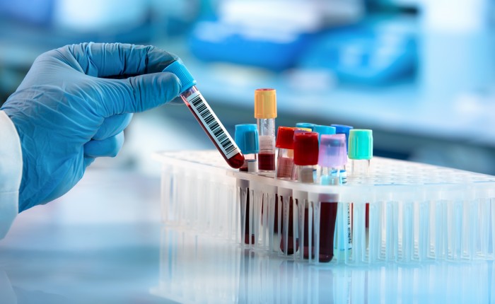 Биохимические исследования крови в Москве в клинике Столица