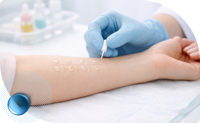 Исследование на индивидуальные аллергены в Москве в клинике Столица Исследование на индивидуальные аллергены в Москве в клинике Столица