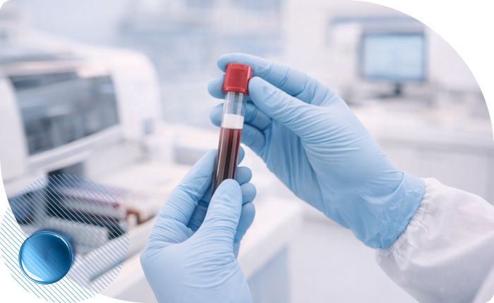 Исследование на онкомаркеры на Ленинском проспекте в Москве в клинике Столица Исследование на онкомаркеры на Ленинском проспекте в Москве в клинике Столица