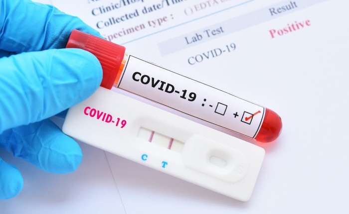 Тест на антитела к коронавирусу в Москве в клинике Столица