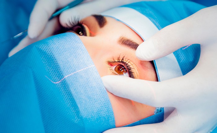 Факоэмульсификация с имплантацией ИОЛ (удаление катаракты) в Москве в клинике Столица