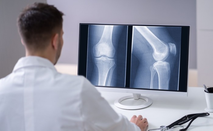 Рентген колена в Москве в клинике Столица