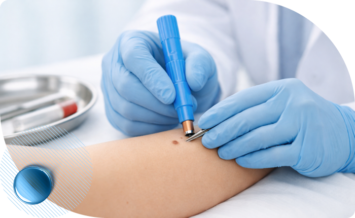 Биопсия на Профсоюзной м Беляево в клинике Столица Биопсия на Профсоюзной м Беляево в клинике Столица