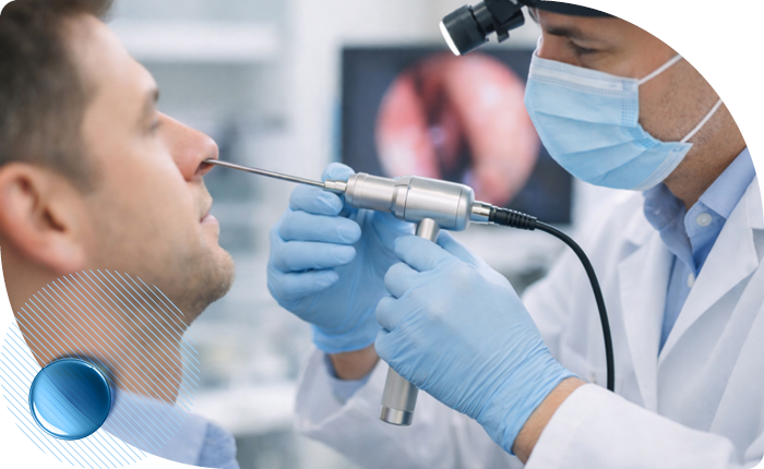 Биопсия полости носа на Профсоюзной м Беляево в клинике Столица